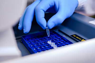 Loading-DNA-PCR
