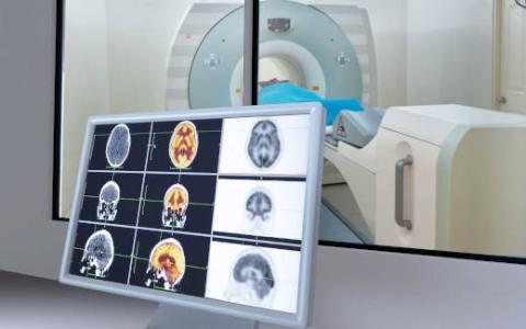 Thermal Control of MRI Systems